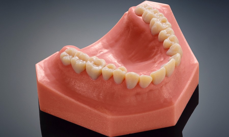3D-принтер в кабинете стоматолога уже печатает зубы