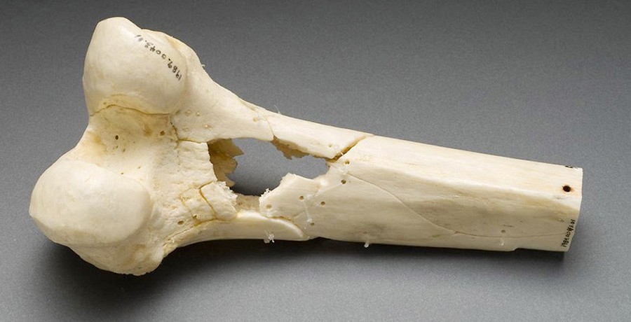 3D-принтер поможет костям срастись