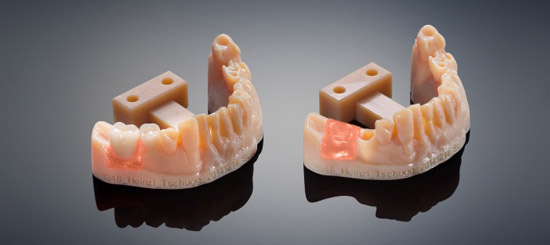 3D-принтер в кабинете стоматолога уже печатает зубы